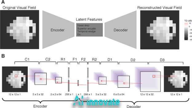 Neural network encoder-decoder diagram showing latent features and visual field reconstruction, illustrating deep learning image encoding and decoding process.